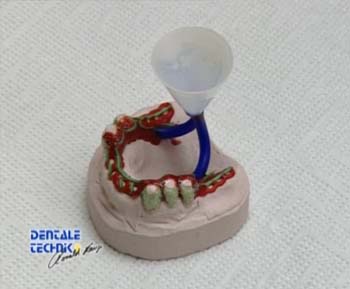 Technik und Perfektion